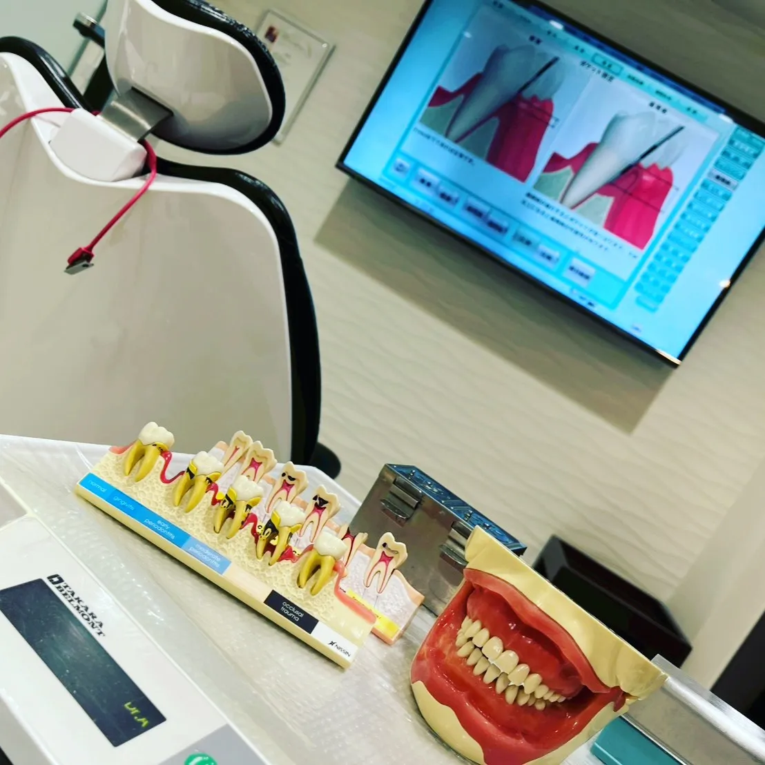 虫歯が気になる皆様へ✨