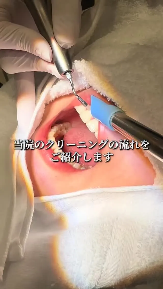 皆さんも歯の定期検診を受けてお口の健康を守りましょう🦷